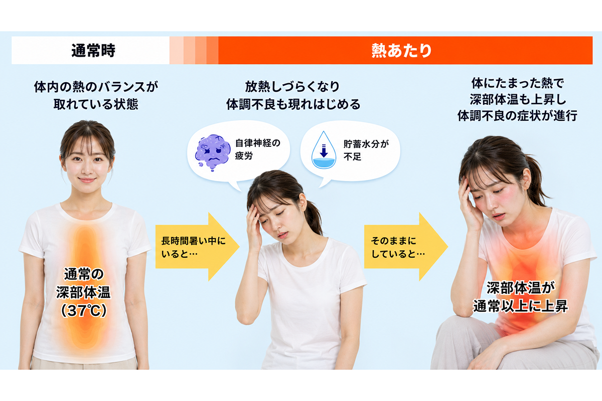体に熱がこもると、だるさや疲労感、集中力の低下など、いわゆる「夏バテ」に近い不調として現れることもあります。熱中症に至る前の段階から、体のサインを見逃さないことが大切です